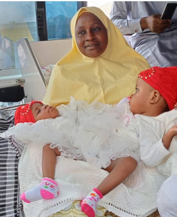 Conjoined Twins, Return, Kano, Successful Separation, Saudi Arabia